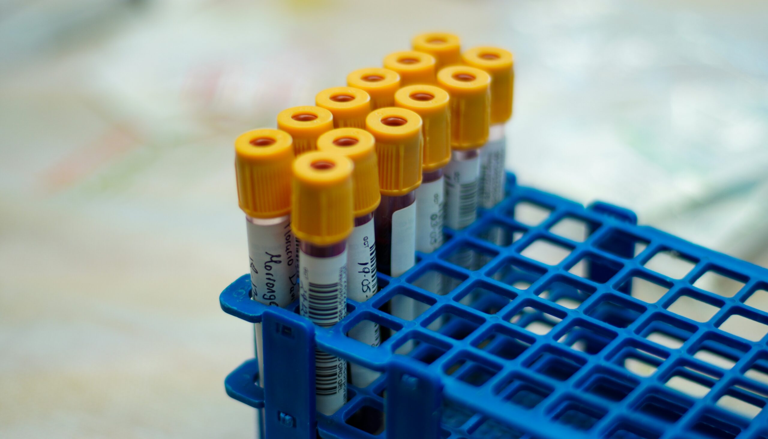 Cancer in Canada: Nearly all Canadians support federal government increasing access to clinical trials